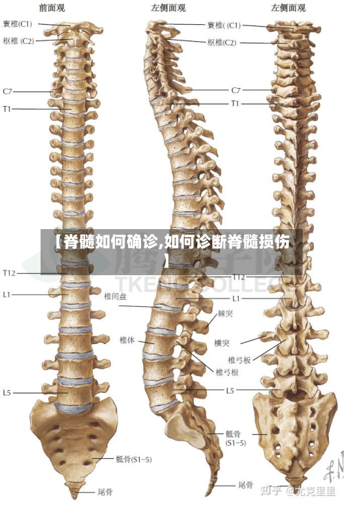 【脊髓如何确诊,如何诊断脊髓损伤】