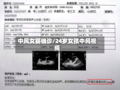 中风女婴确诊/24岁女孩中风视频-第3张图片