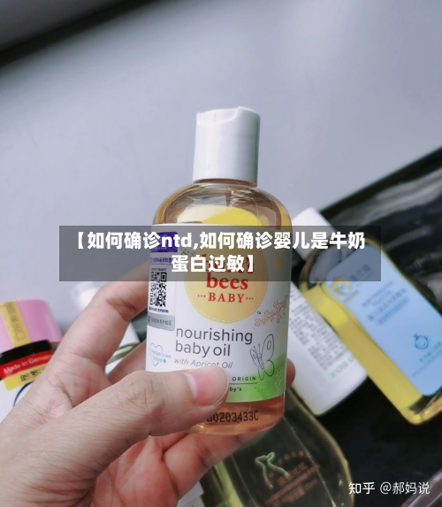 【如何确诊ntd,如何确诊婴儿是牛奶蛋白过敏】-第3张图片