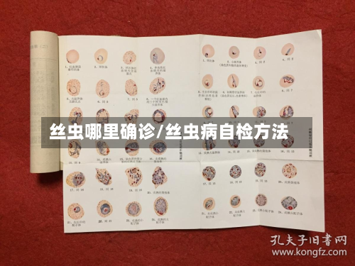 丝虫哪里确诊/丝虫病自检方法