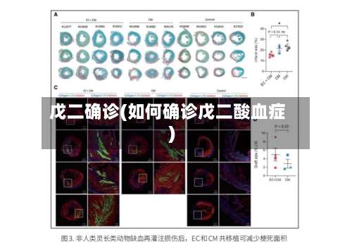 戊二确诊(如何确诊戊二酸血症)-第3张图片