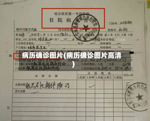 病历确诊图片(病历确诊图片高清)-第3张图片
