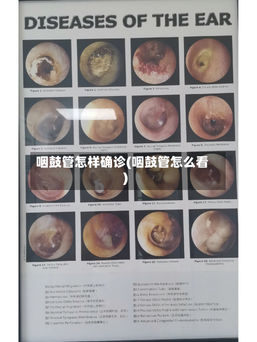 咽鼓管怎样确诊(咽鼓管怎么看)