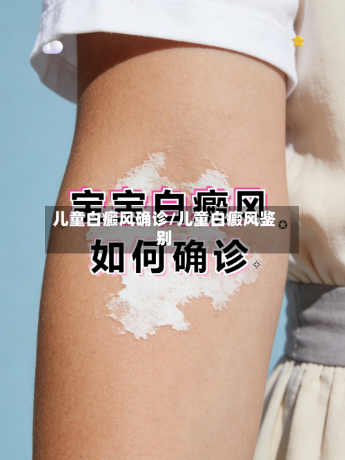 儿童白癜风确诊/儿童白癜风鉴别