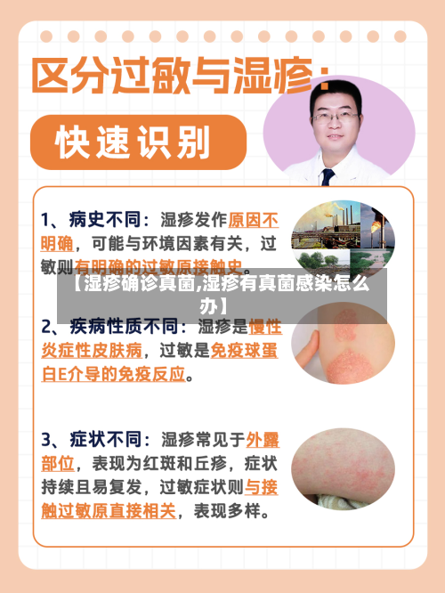 【湿疹确诊真菌,湿疹有真菌感染怎么办】