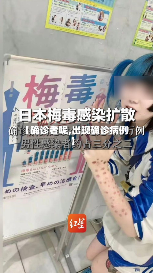 【确诊者呢,出现确诊病例】