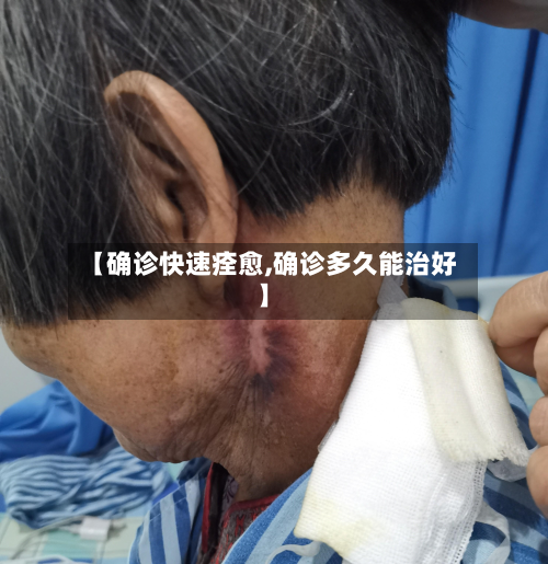 【确诊快速痊愈,确诊多久能治好】