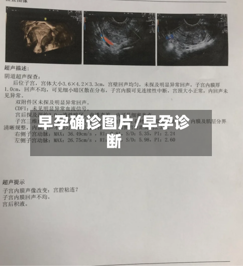 早孕确诊图片/早孕诊断