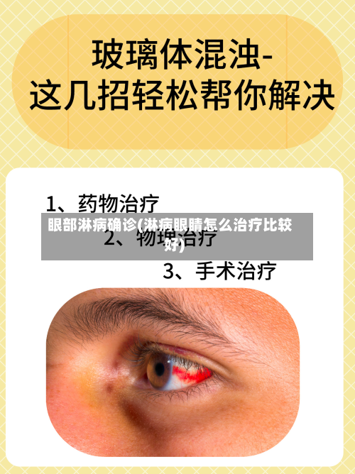 眼部淋病确诊(淋病眼睛怎么治疗比较好)-第3张图片