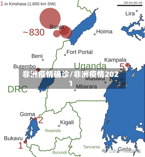 非洲疫情确诊/非洲疫情2021
