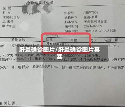 肝炎确诊图片/肝炎确诊图片真实