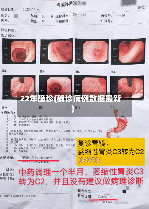 22年确诊(确诊病例数据最新)-第3张图片