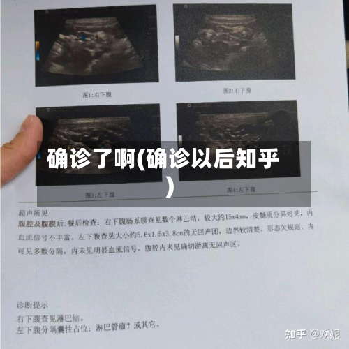 确诊了啊(确诊以后知乎)