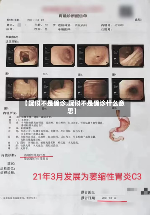 【疑似不是确诊,疑似不是确诊什么意思】-第2张图片