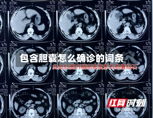 包含胆囊怎么确诊的词条