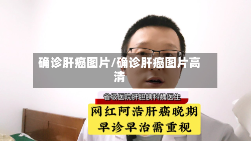 确诊肝癌图片/确诊肝癌图片高清-第2张图片