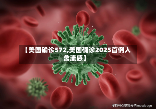 【美国确诊572,美国确诊2025首例人禽流感】