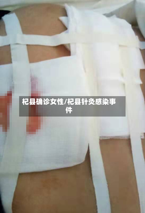 杞县确诊女性/杞县针灸感染事件