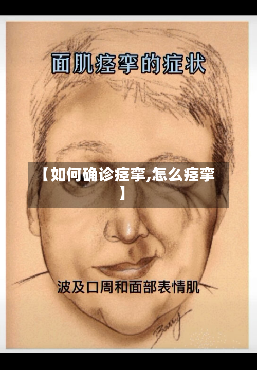 【如何确诊痉挛,怎么痉挛】-第2张图片