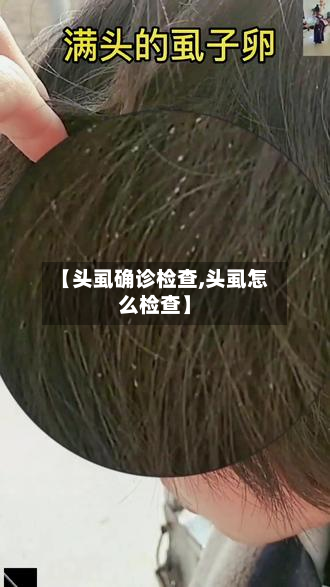 【头虱确诊检查,头虱怎么检查】-第3张图片