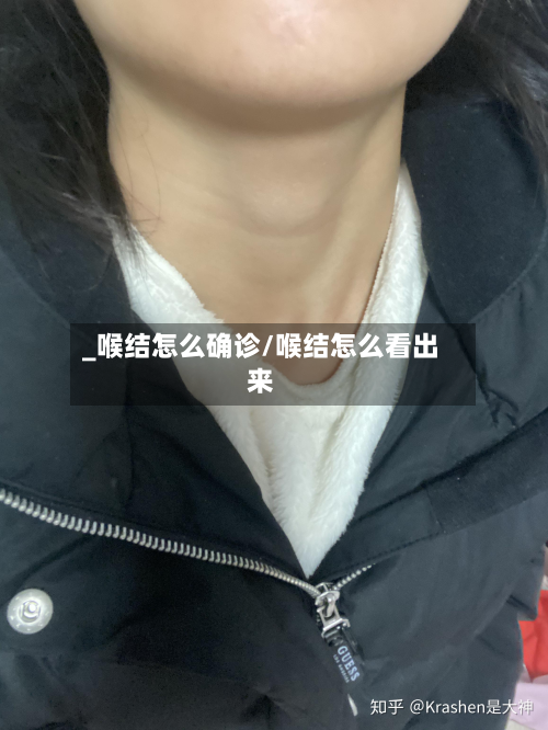 _喉结怎么确诊/喉结怎么看出来