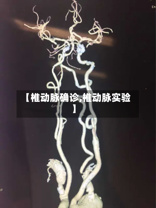 【椎动脉确诊,椎动脉实验】-第2张图片