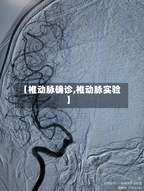 【椎动脉确诊,椎动脉实验】