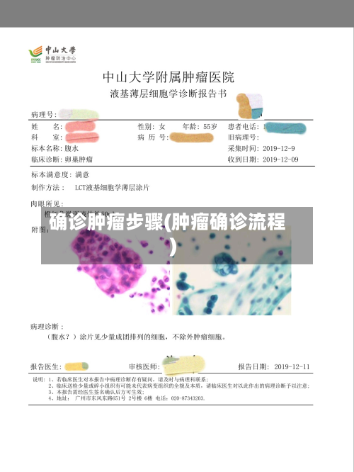 确诊肿瘤步骤(肿瘤确诊流程)