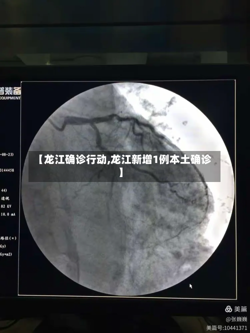 【龙江确诊行动,龙江新增1例本土确诊】-第3张图片