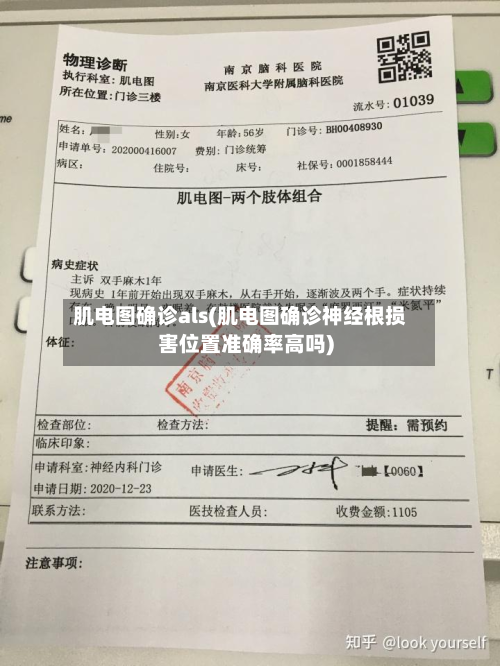 肌电图确诊als(肌电图确诊神经根损害位置准确率高吗)-第3张图片