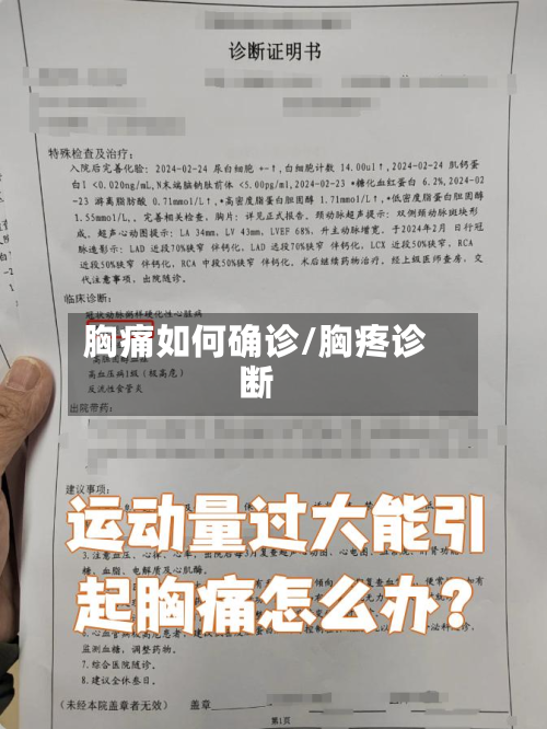 胸痛如何确诊/胸疼诊断-第2张图片