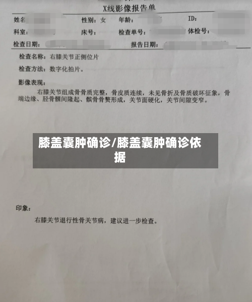 膝盖囊肿确诊/膝盖囊肿确诊依据