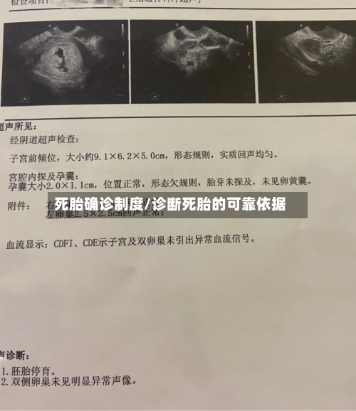 死胎确诊制度/诊断死胎的可靠依据
