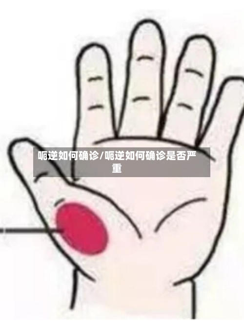 呃逆如何确诊/呃逆如何确诊是否严重-第3张图片