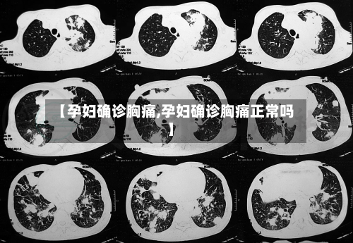 【孕妇确诊胸痛,孕妇确诊胸痛正常吗】-第2张图片