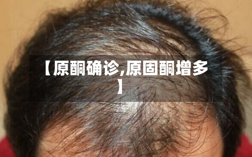 【原酮确诊,原固酮增多】
