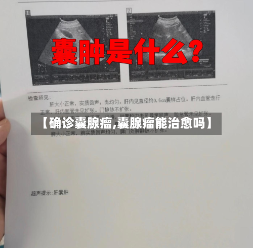 【确诊囊腺瘤,囊腺瘤能治愈吗】-第3张图片