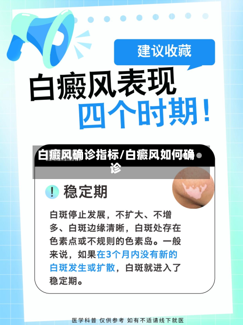 白癜风确诊指标/白癜风如何确诊