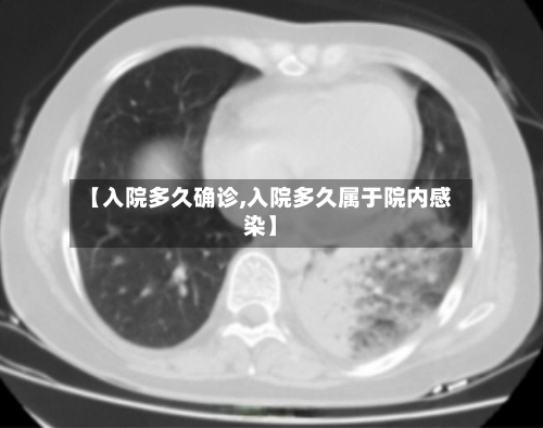 【入院多久确诊,入院多久属于院内感染】-第2张图片