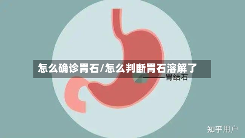 怎么确诊胃石/怎么判断胃石溶解了-第2张图片