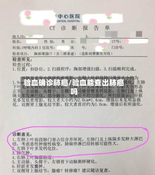 验血确诊肺癌/验血能查出肺癌吗-第2张图片