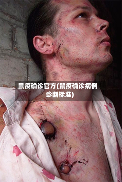 鼠疫确诊官方(鼠疫确诊病例诊断标准)