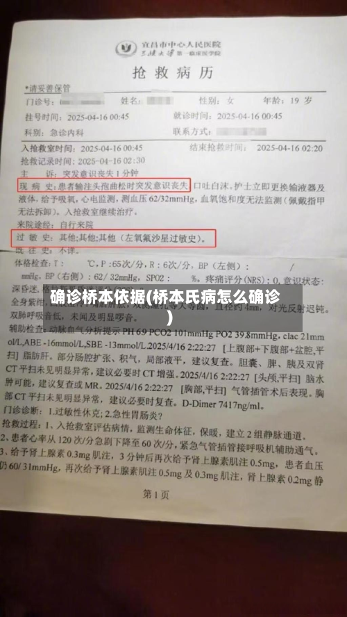 确诊桥本依据(桥本氏病怎么确诊)-第2张图片