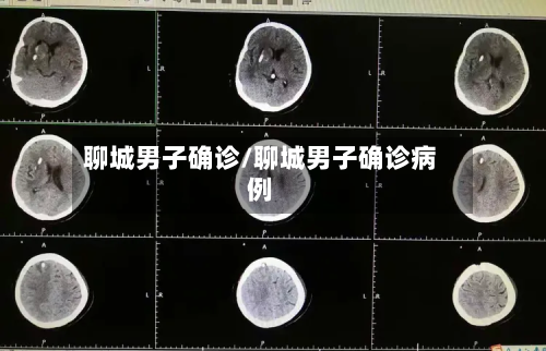 聊城男子确诊/聊城男子确诊病例-第2张图片
