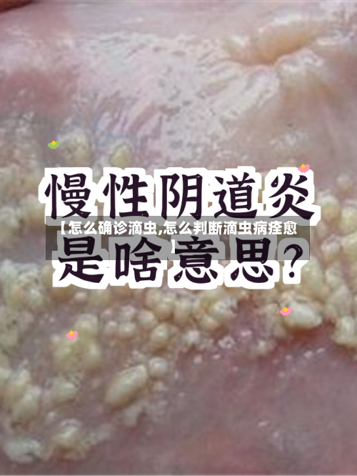 【怎么确诊滴虫,怎么判断滴虫病痊愈】-第2张图片