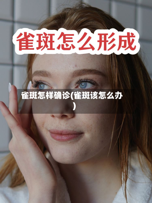 雀斑怎样确诊(雀斑该怎么办)