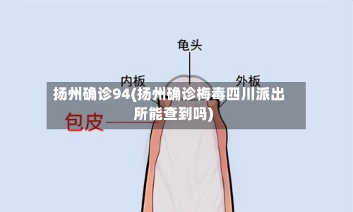 扬州确诊94(扬州确诊梅毒四川派出所能查到吗)