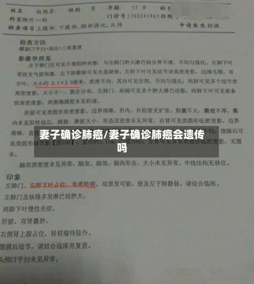 妻子确诊肺癌/妻子确诊肺癌会遗传吗-第3张图片