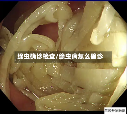 绦虫确诊检查/绦虫病怎么确诊