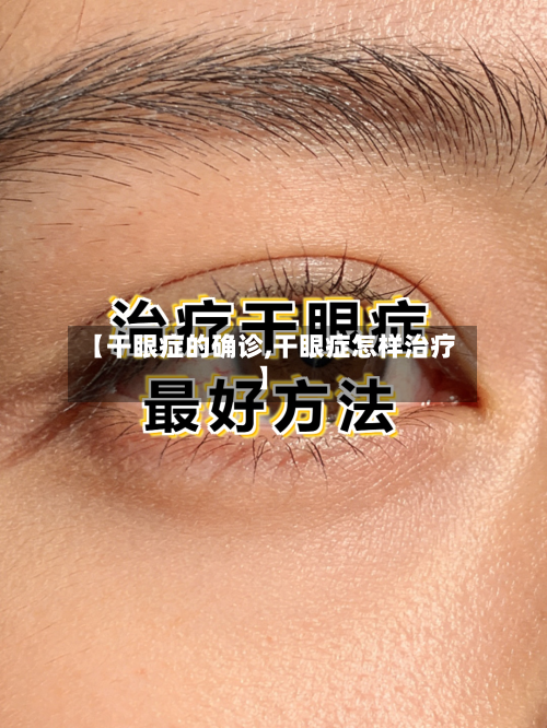 【干眼症的确诊,干眼症怎样治疗】